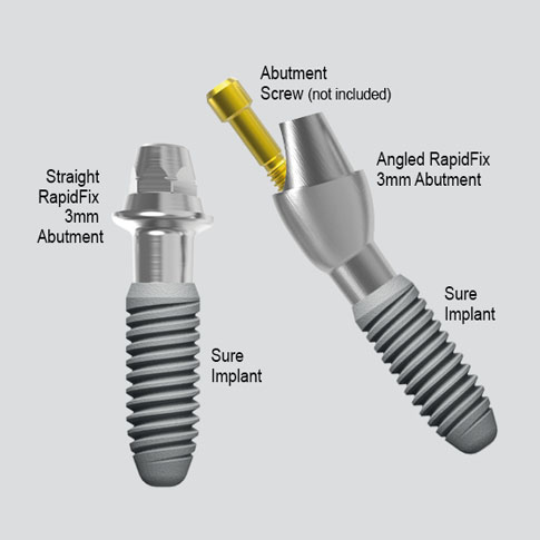 Rapid Fix Abutments (VBA) - Complete Dental Implant Solutions