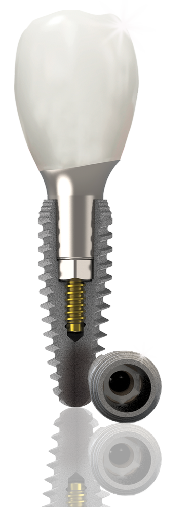 k3-dental-Implant-hero-2